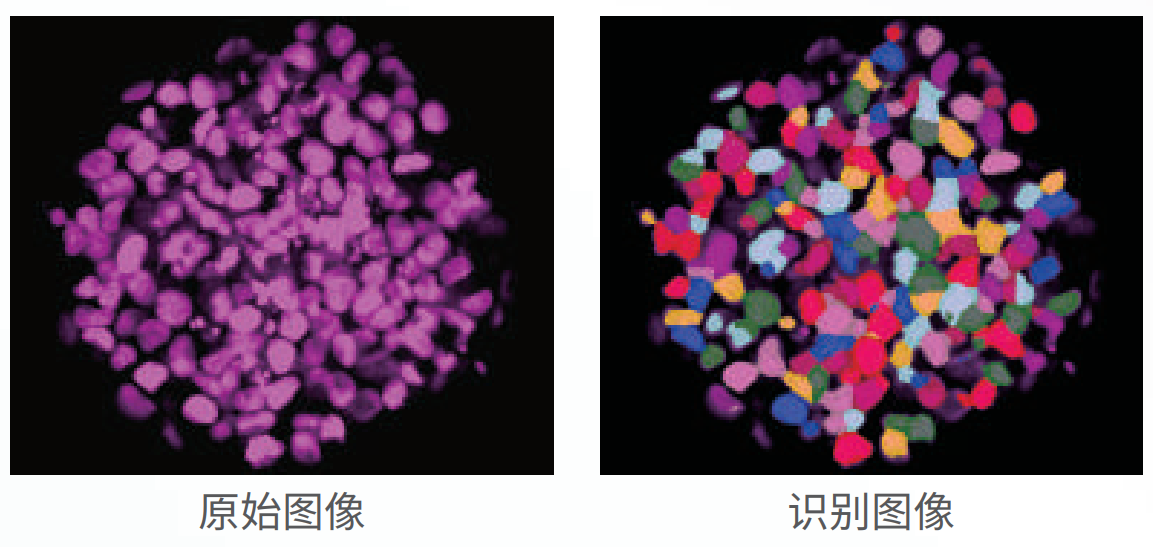 應(yīng)用3：類器官、球體成像.png